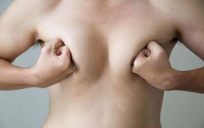 Γυναικομαστία